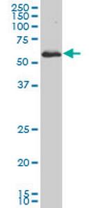 PRKAA1 Antibody in Western Blot (WB)