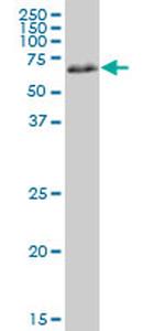 PRKAA1 Antibody in Western Blot (WB)