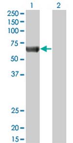 PRKAA2 Monoclonal Antibody (1G8)