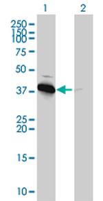 PRKAB1 Antibody in Western Blot (WB)
