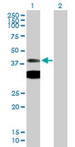PRKAR1A Polyclonal Antibody, MaxPab™