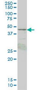 PRKAR1B Monoclonal Antibody (1F8)