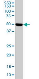 PRKAR2A Monoclonal Antibody (6A9)