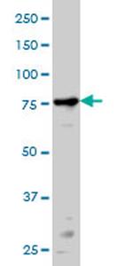 PRKCA Antibody in Western Blot (WB)
