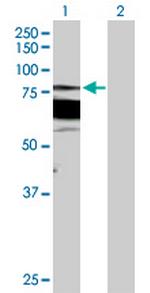 PRKCB Polyclonal Antibody, MaxPab™
