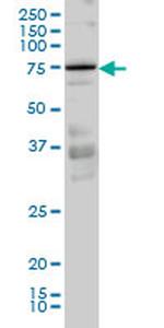 PRKCI Monoclonal Antibody (3A7)