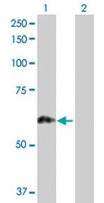 PRKCSH Antibody in Western Blot (WB)