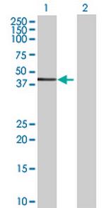 PRKG1 Polyclonal Antibody, MaxPab™