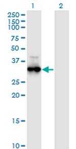 PRKG1 Monoclonal Antibody (5E5)