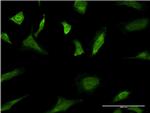 MAPK3 Monoclonal Antibody (3D6)