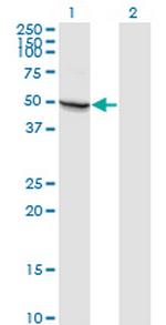 MAPK8 Monoclonal Antibody (3H2)