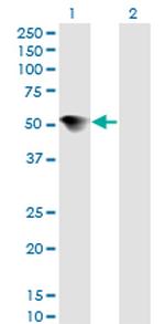 MAPK8 Antibody in Western Blot (WB)