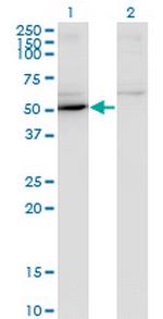 MAPK8 Antibody in Western Blot (WB)