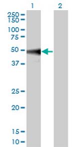MAPK9 Monoclonal Antibody (1C1-3A8)