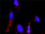MAP2K3 Antibody in Proximity Ligation Assay (PLA) (PLA)