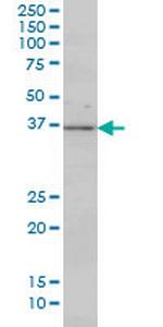 MAP2K3 Antibody in Western Blot (WB)