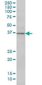 MAP2K3 Antibody in Western Blot (WB)