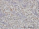 MAP2K3 Monoclonal Antibody (1D10)