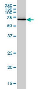EIF2AK2 Antibody in Western Blot (WB)