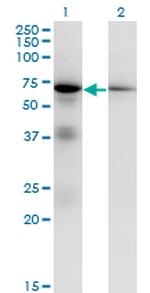 EIF2AK2 Antibody in Western Blot (WB)