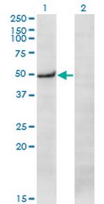 PRKX Monoclonal Antibody (1H7)