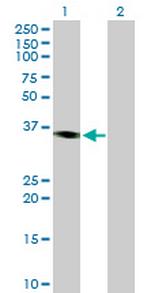 PRKY Antibody in Western Blot (WB)