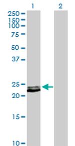 PRL Polyclonal Antibody, MaxPab™