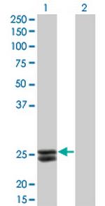 PRL Monoclonal Antibody (1E1)