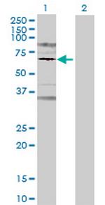 PRLR Antibody in Western Blot (WB)