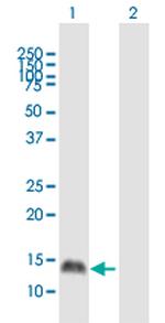 PRM1 Polyclonal Antibody, MaxPab™