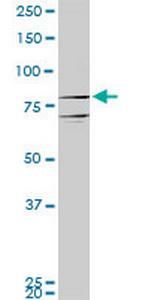 PROX1 Monoclonal Antibody (1H6)