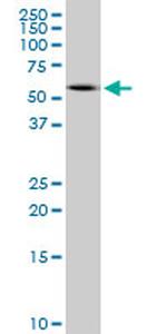 PRPH Antibody in Western Blot (WB)
