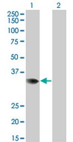 PRPS2 Monoclonal Antibody (4C1)
