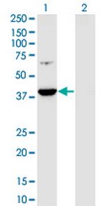 PRPSAP1 Monoclonal Antibody (5H10)