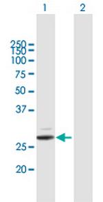 PRSS2 Polyclonal Antibody, MaxPab™