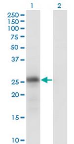 KLK6 Monoclonal Antibody (4A10)