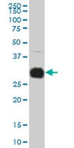 KLK10 Antibody in Western Blot (WB)