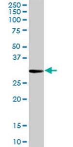 PRTN3 Antibody in Western Blot (WB)
