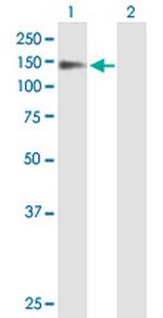 PSD Polyclonal Antibody, MaxPab™