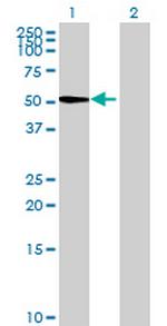 PSG6 Polyclonal Antibody, MaxPab™