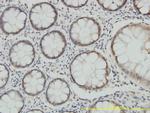 PSMA7 Antibody in Immunohistochemistry (Paraffin) (IHC (P))