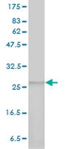 PSMA7 Antibody in Western Blot (WB)
