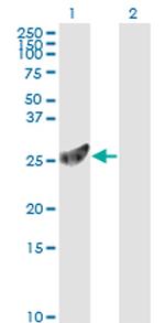 PSMA7 Antibody in Western Blot (WB)
