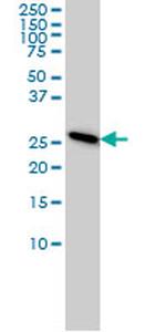 PSMA7 Antibody in Western Blot (WB)