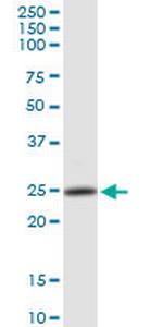 PSMB4 Polyclonal Antibody, MaxPab™
