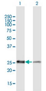 PSMB5 Polyclonal Antibody, MaxPab™