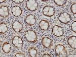 PSMB6 Antibody in Immunohistochemistry (Paraffin) (IHC (P))