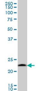 PSMB6 Antibody in Western Blot (WB)