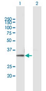 PSMB7 Polyclonal Antibody, MaxPab™