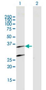 PSMB7 Polyclonal Antibody, MaxPab™